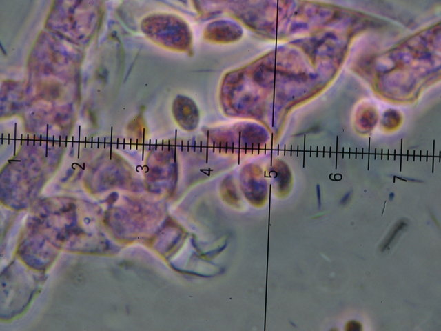 Botryobasidium con spore finemente verrucose